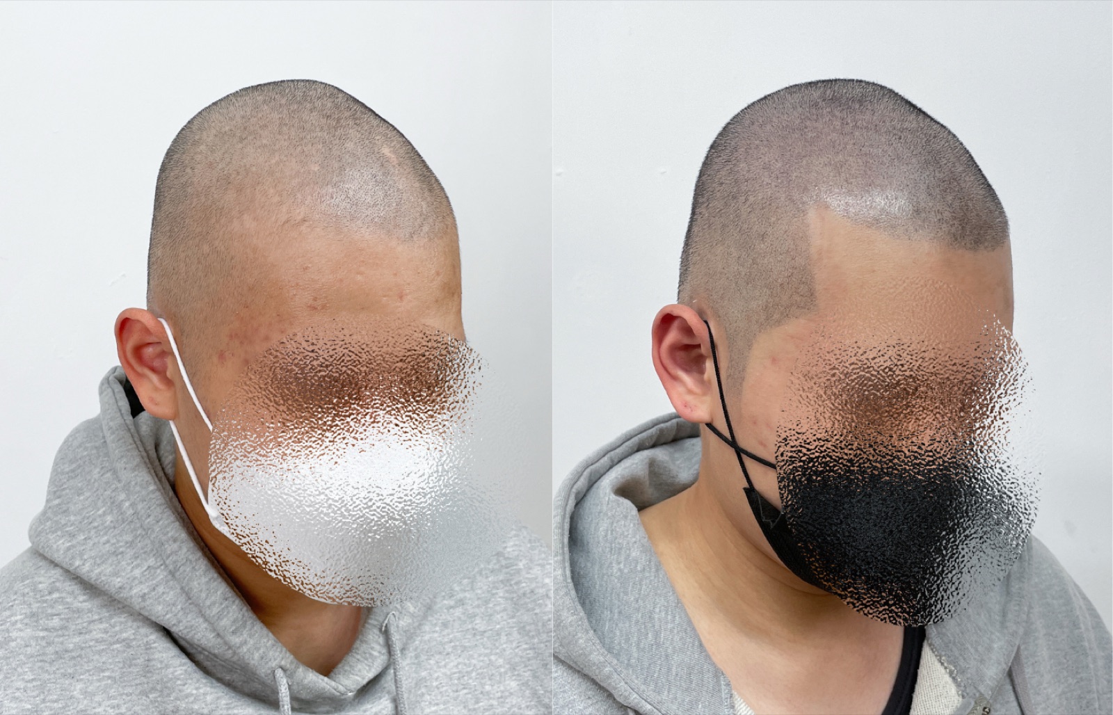 Shaved look SMP portfolio 28